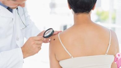 Malign Melanoma Nedir, Belirtileri, Evreleri Nelerdir?